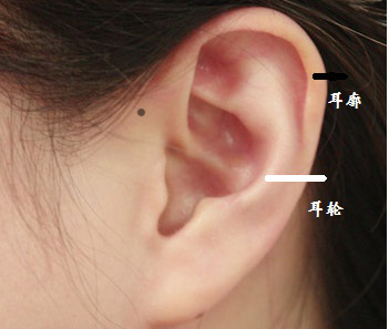 女人耳朵周边长痣图片