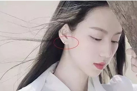 女人耳朵前面有痣代表什么含义