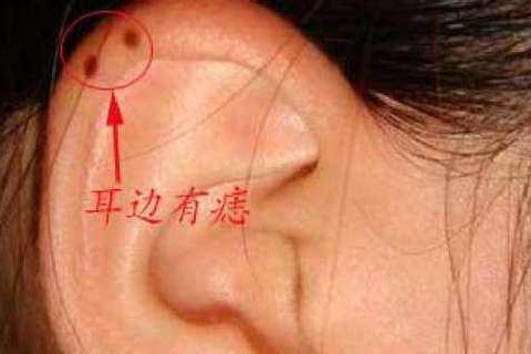 女人耳后有痣财运方面如果女人在耳朵后面长痣,代表了这样痣相特点的
