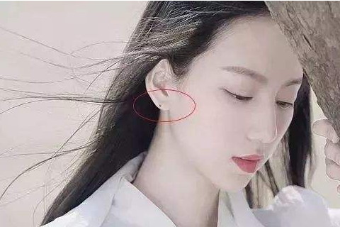 女人耳朵长痣图片